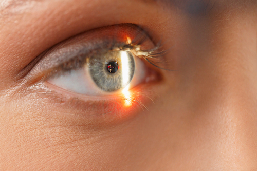 eye.jpg